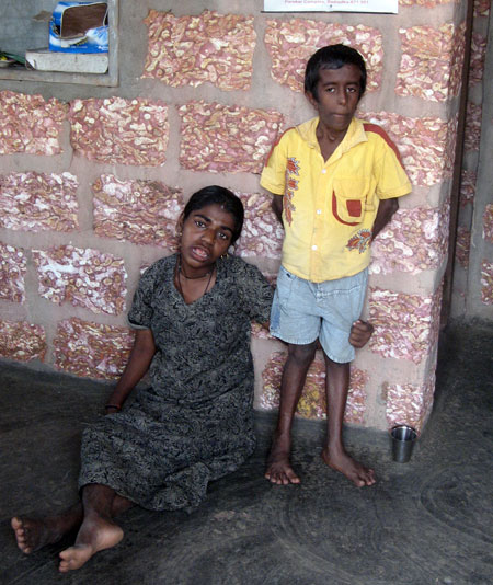Victims of endosulfan with physical deformities and mental problems
