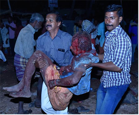 Accident vicitim being taken to hospital